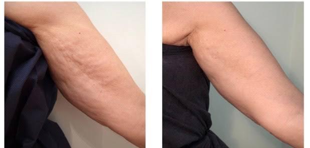 Images ProSculpt Med Spa