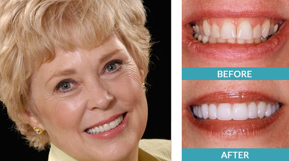 Images Eric Hull DDS Aesthetic & General Dentistry