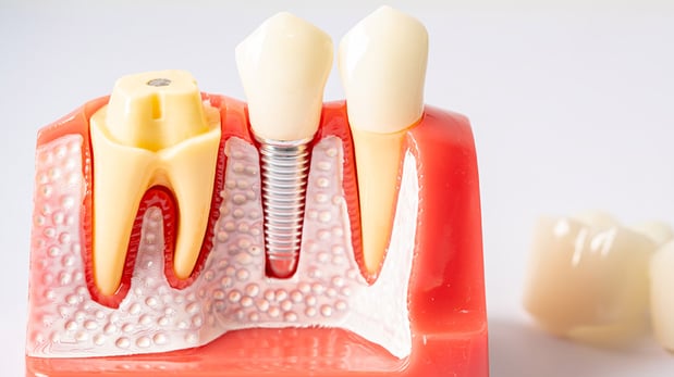 Images Harborside Dental Team