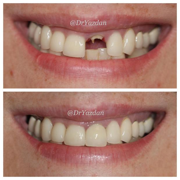 Images Dr. Desiree Yazdan - Center For Restorative & Cosmetic Dentistry