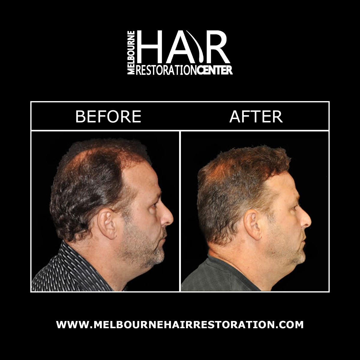 Melbourne Hair Restoration Center Image