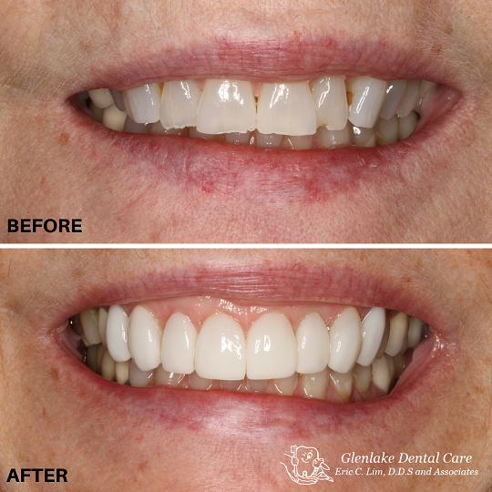 Images Glenlake Dental Care