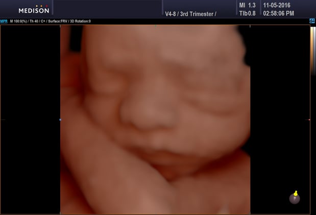 Images Heavenly 3D 4D Ultrasounds