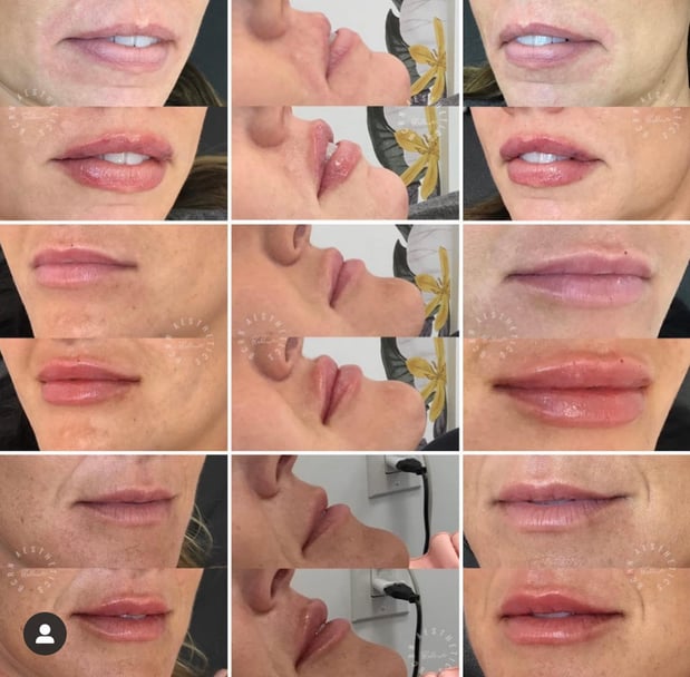Images BCRN Aesthetics MedSpa