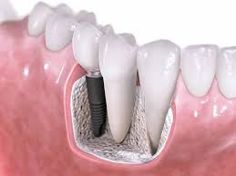 Images Guzaitis Dental Group