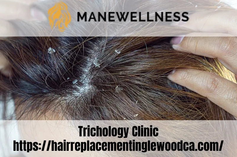 Images Mane Wellness Hair Loss Center