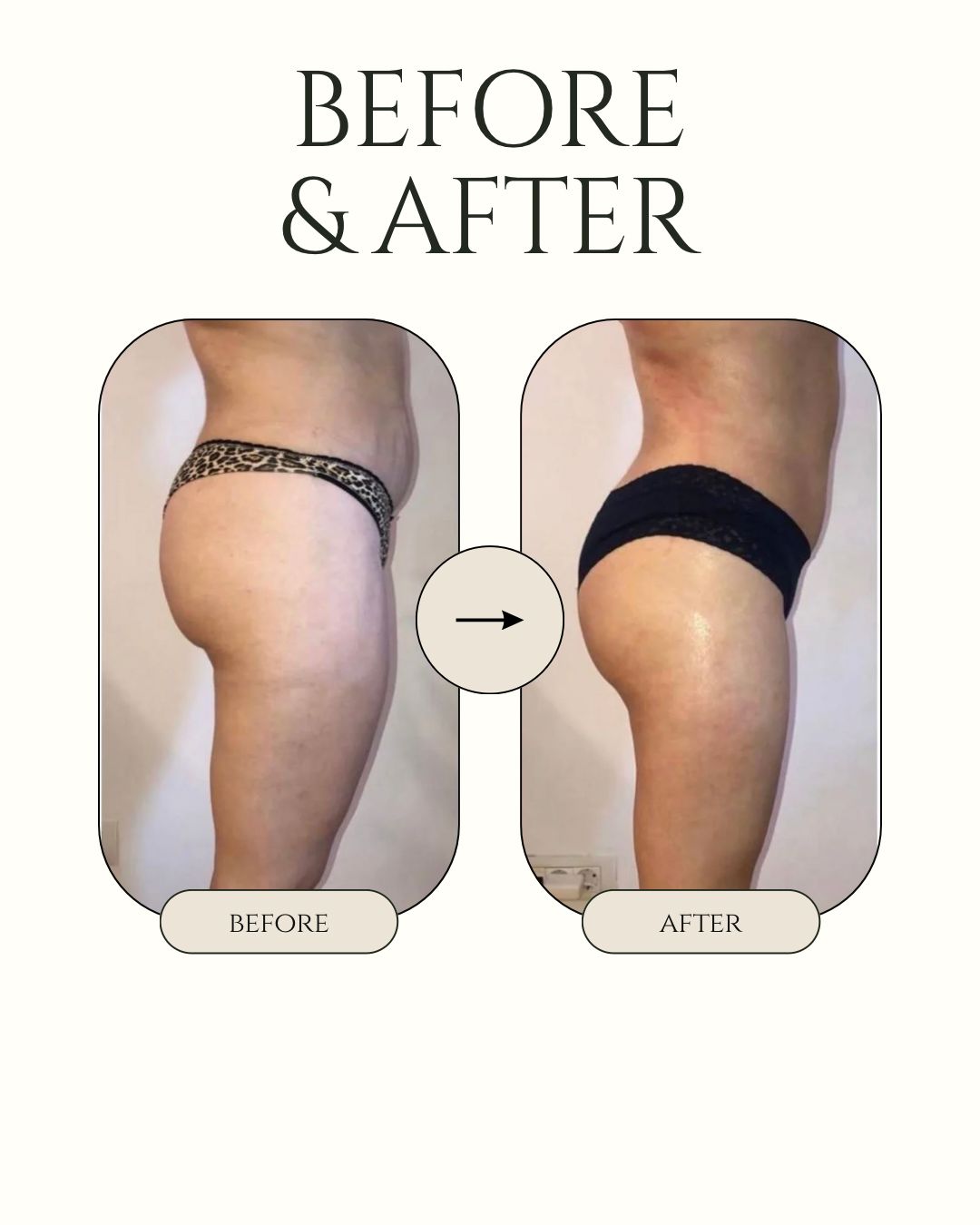 Images HOLLYWOOD BODY&FACE