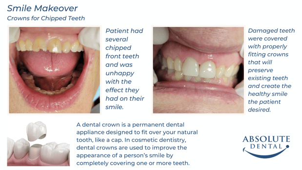 Images Absolute Dental