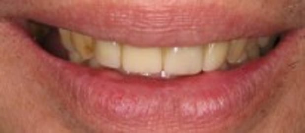 Images Glenlake Dental Care