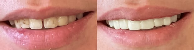 Images River Oak Dental