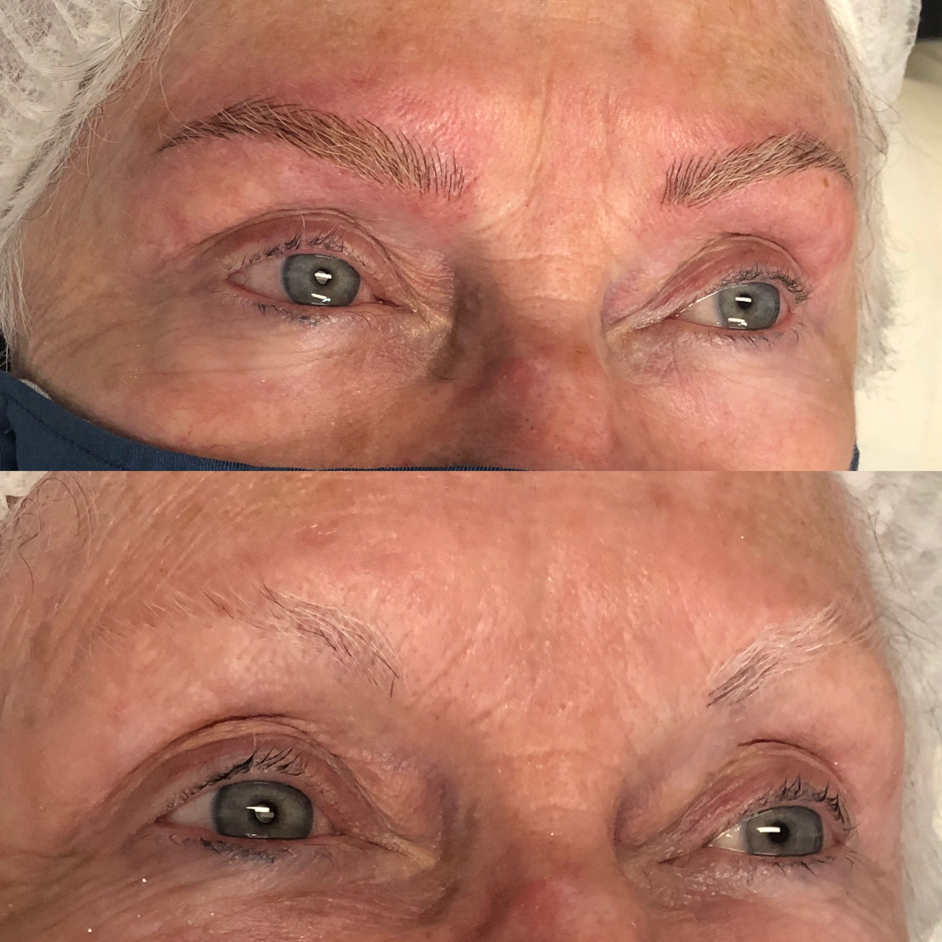 Images Clinique d'Esthétique Leila - Hydrafacial, Microblading, Épilation Laser Sainte-Foy
