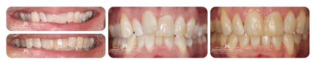 Images Aspire Dental Care PLLC