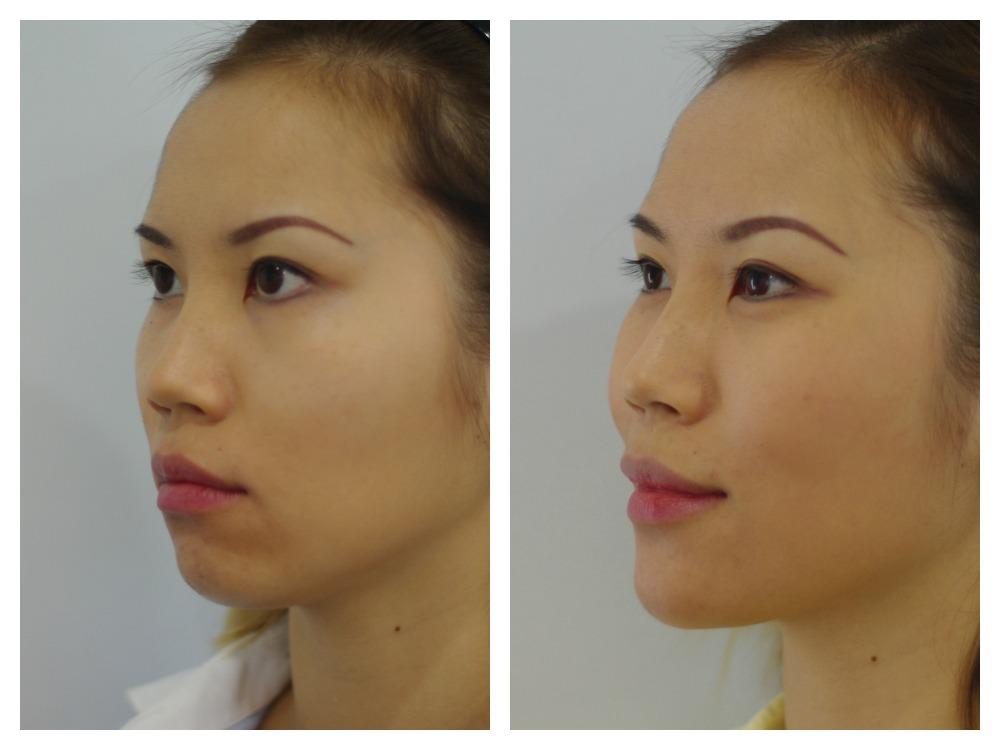 Images About Face Medical Aesthetics - Richmond