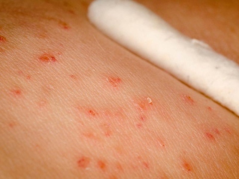 Images Coronese Dr. Antonio