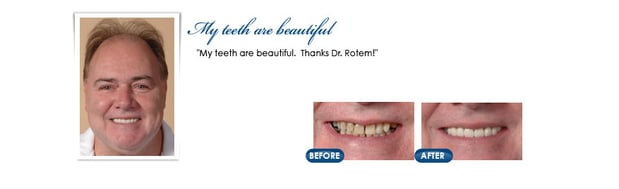 Images Rotem Dental Care