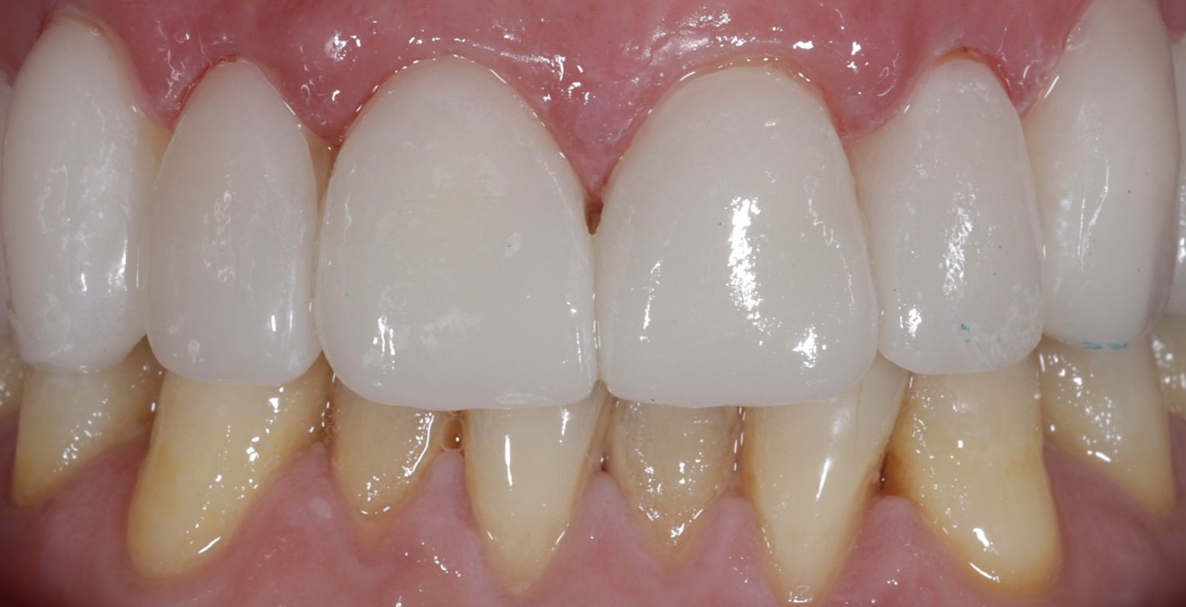 Images Dentalex