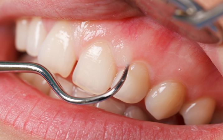 Images Clinique Dentaire Dr. Karam - Dentiste, Blanchiment Dentaire Ahuntsic