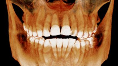 Fotos de Ortho Imagen Radiología Dental