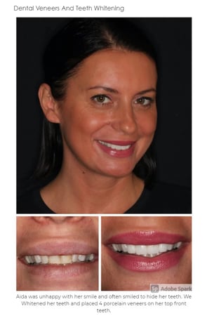 Images The Dental Design Center - Cosmetic, Implant & General Dentistry