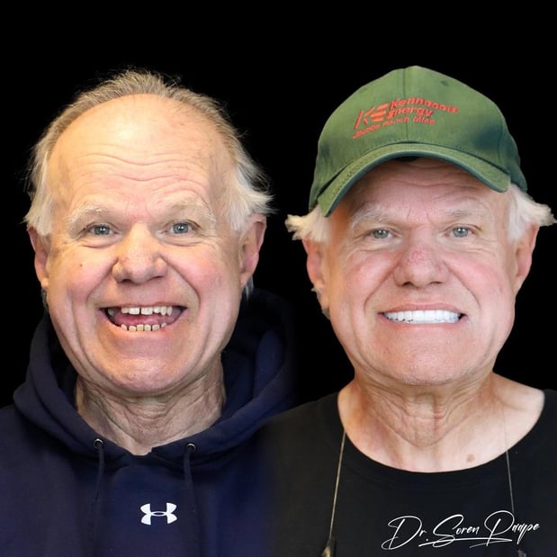 Images Smile Now Denver Dentures and Implants