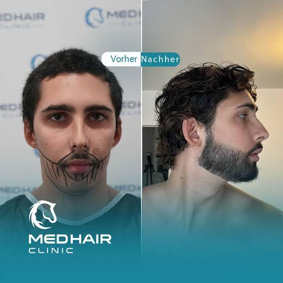 MedHair Clinic | Haartransplantationen in der Türkei Istanbul, Höninger Weg 176 in Rodenkirchen