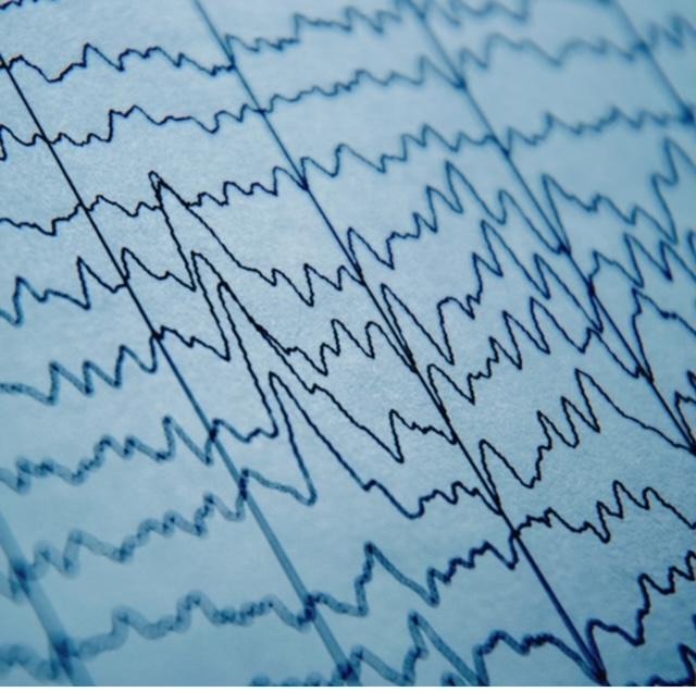 Images Reign-Bow Brain Treatment Center