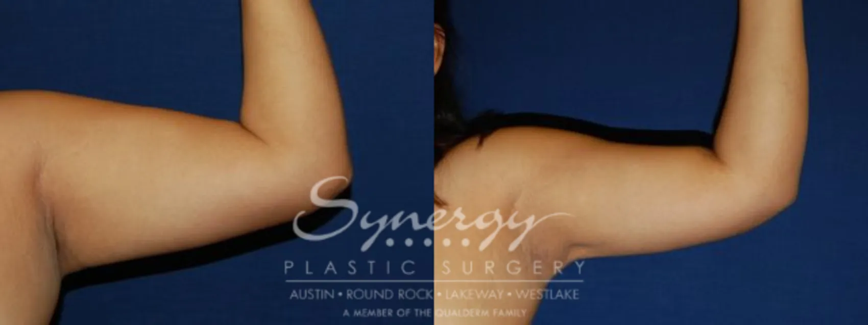 Synergy Plastic Surgery