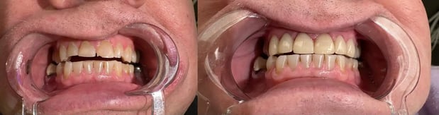 Images Twin Branch Dental