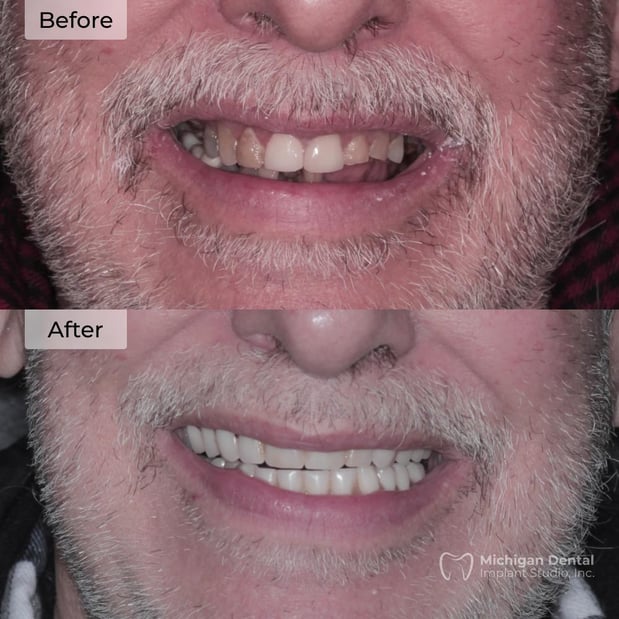 Images Michigan Dental Implant Studio