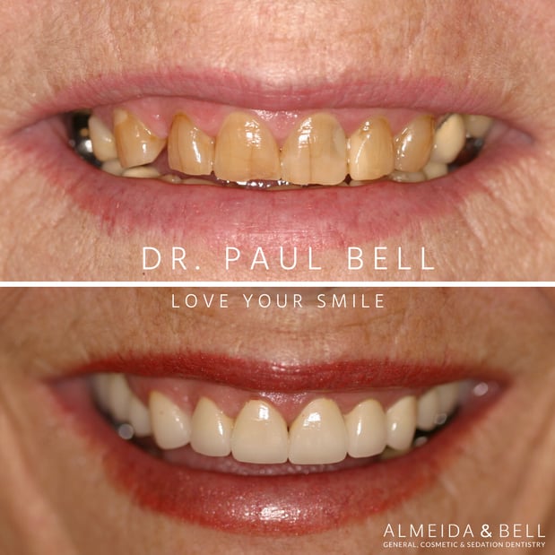 Images Almeida & Bell Dental Lone Tree - General, Cosmetic, and Implant Dentistry