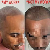Images The Scalp Master
