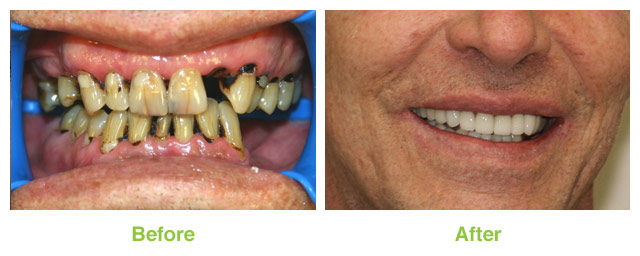 Images Salt Lake Dental Care - Clint Blackwood DDS