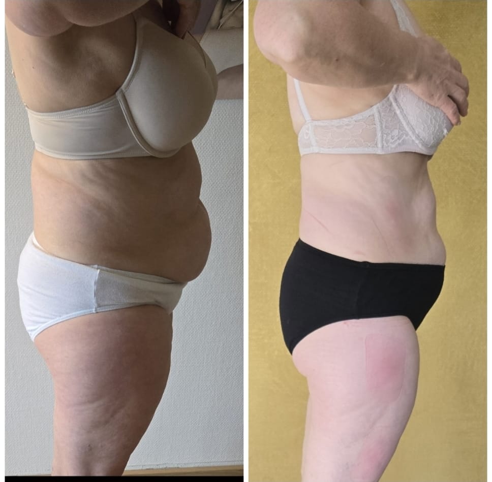 Bilder Abnehmen im liegen St Gallen