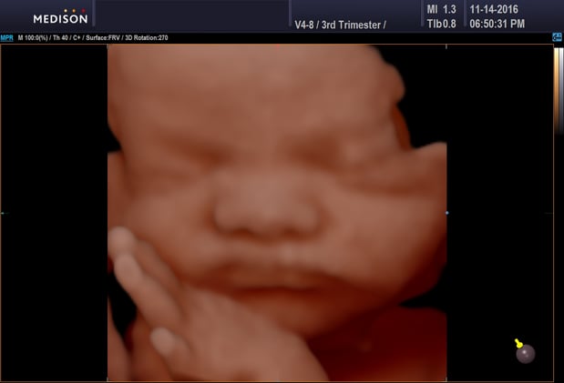 Images Heavenly 3D 4D Ultrasounds