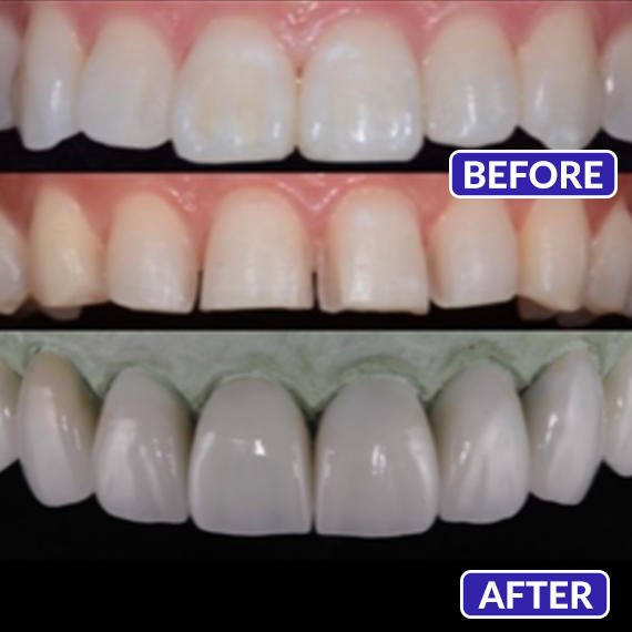 Images Smile Design Dentistry & Implant Center