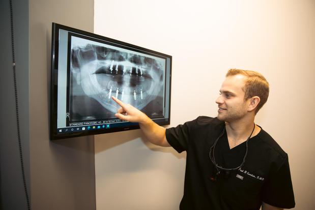 Images Restore In 24 Dental Implants