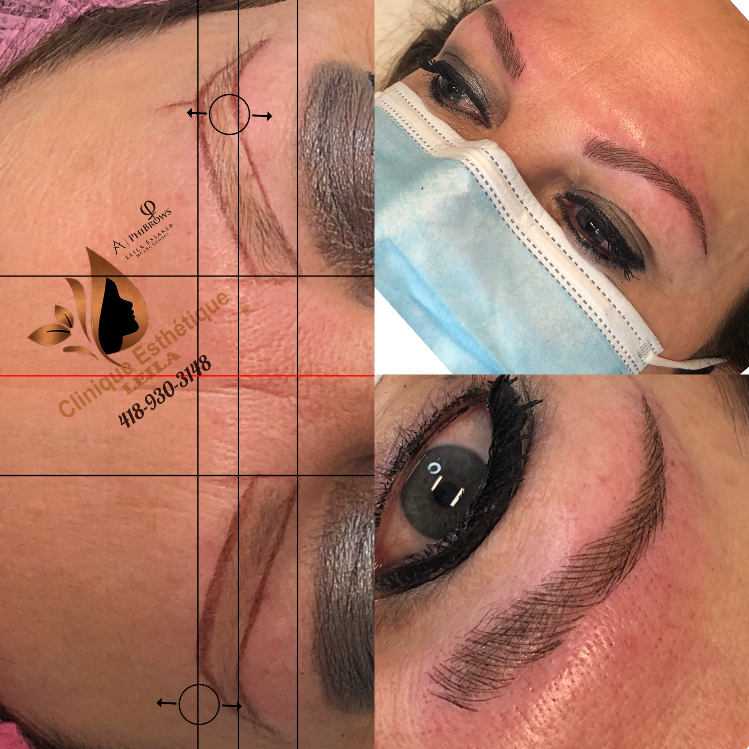 Images Clinique d'Esthétique Leila - Hydrafacial, Microblading, Épilation Laser Sainte-Foy