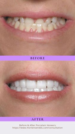 Images Andrew G. Mortensen, DDS