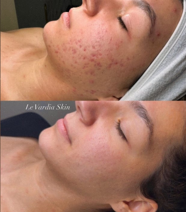 Images Le Vardia Skin