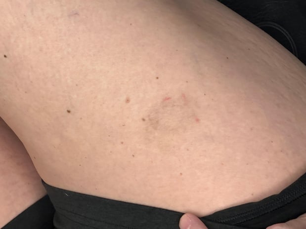 Images TruCanvas Aesthetics