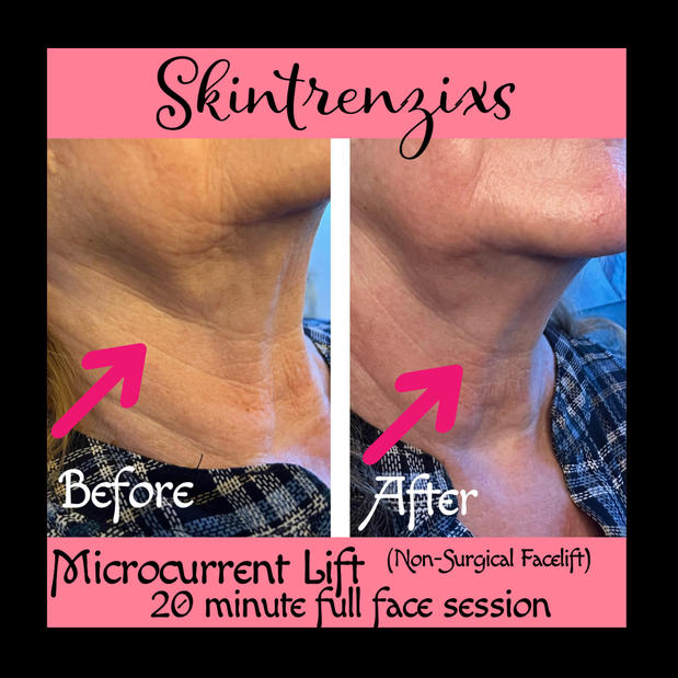 Images Melissa Cundiff Esthetics Birmingham