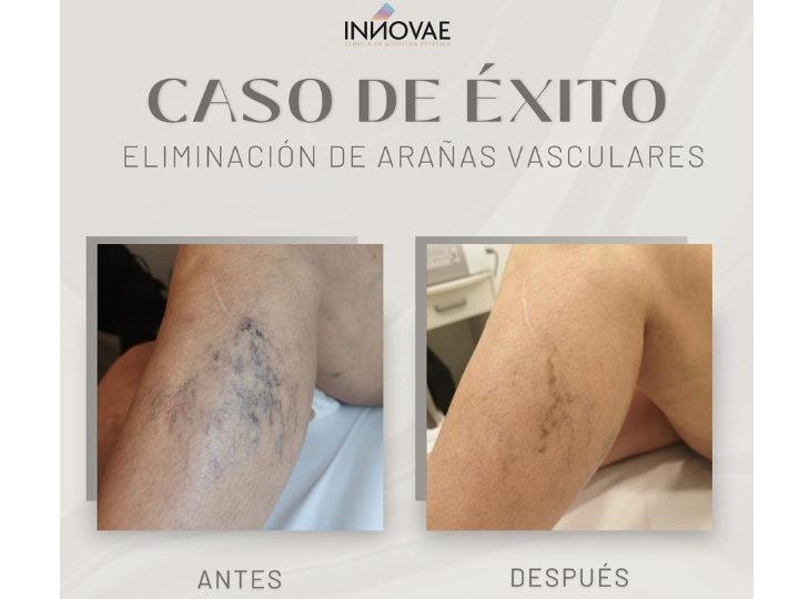 Images Clínica Innovae Medicina Estética