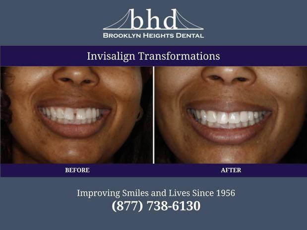 Images Brooklyn Heights Dental