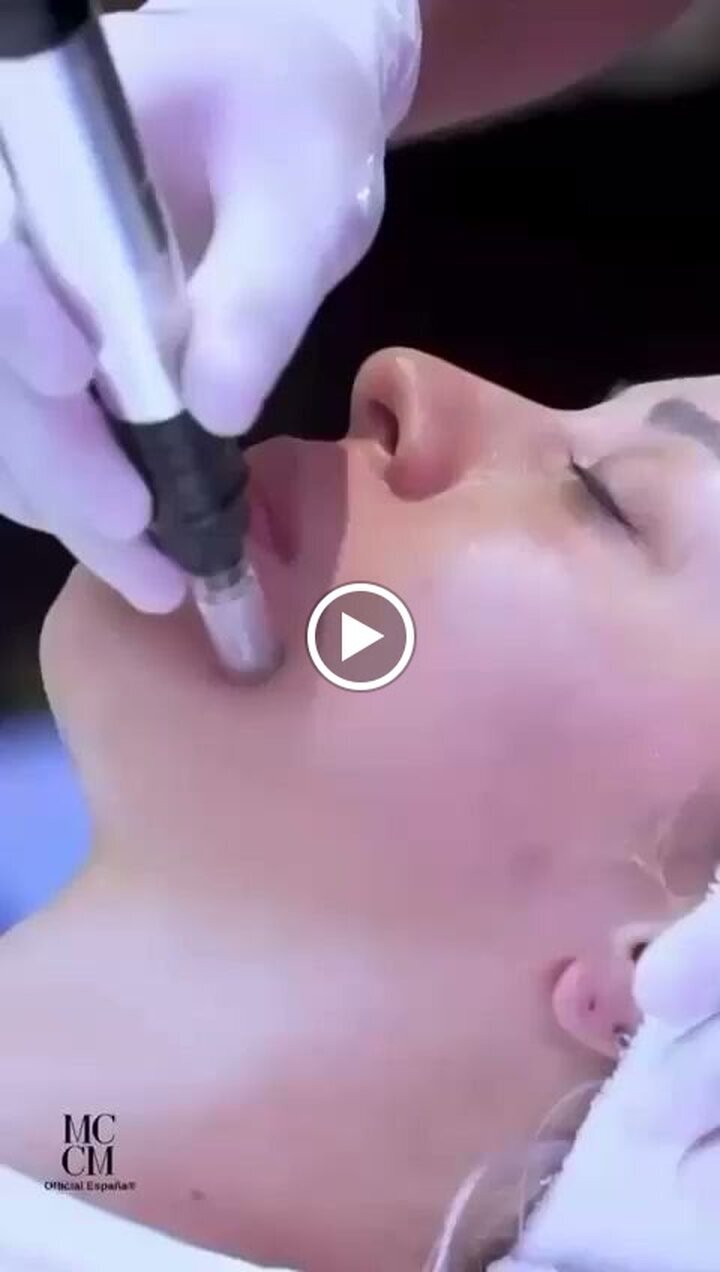 Images Diodolaser Madrid