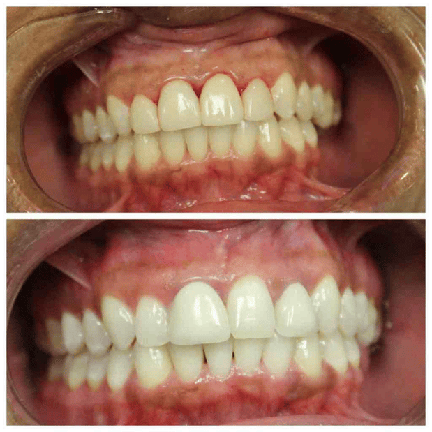 Images Summer Creek Dental