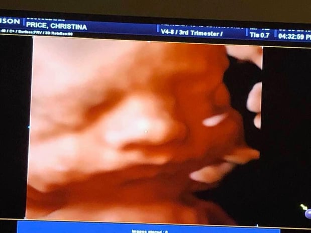 Images Heavenly 3D 4D Ultrasounds