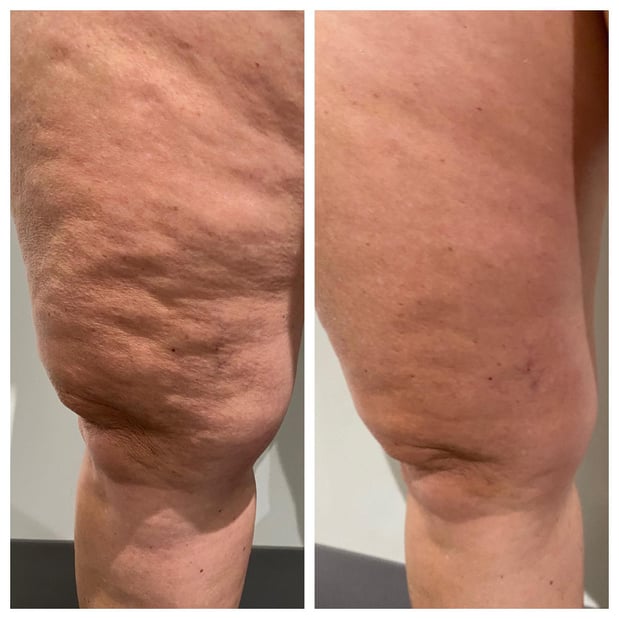 Images Renew Body Contouring & MedSpa