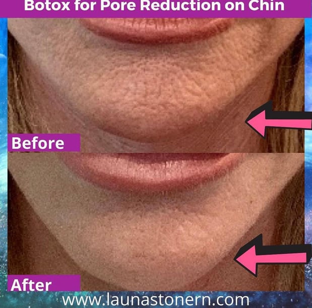 Images Launa Stone, R.N.