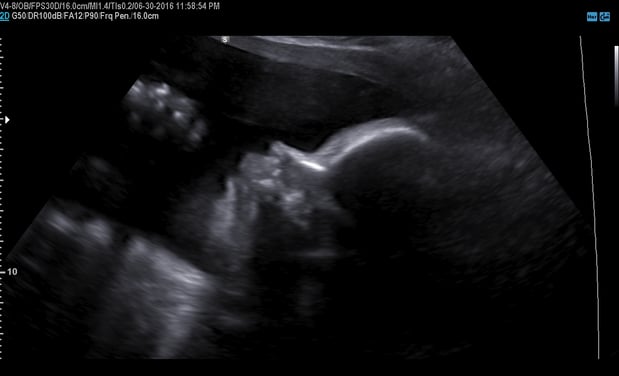 Images Heavenly 3D 4D Ultrasounds
