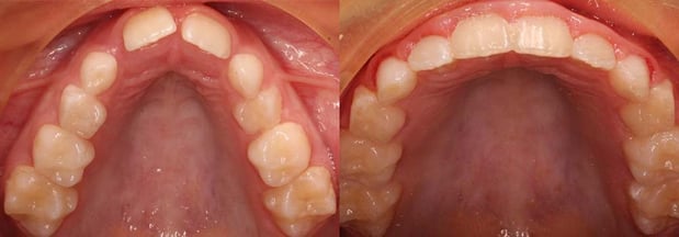 Images TLC Pediatric Dentistry and Orthodontics